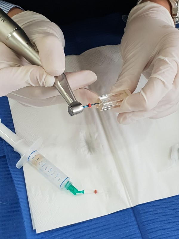 Endodontija s sistemom Reciproc: pot do apeksa