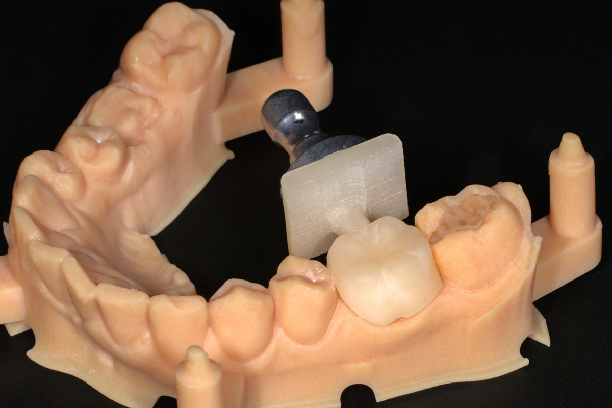 Digitalne rešitve - standard v zobozdravstvu