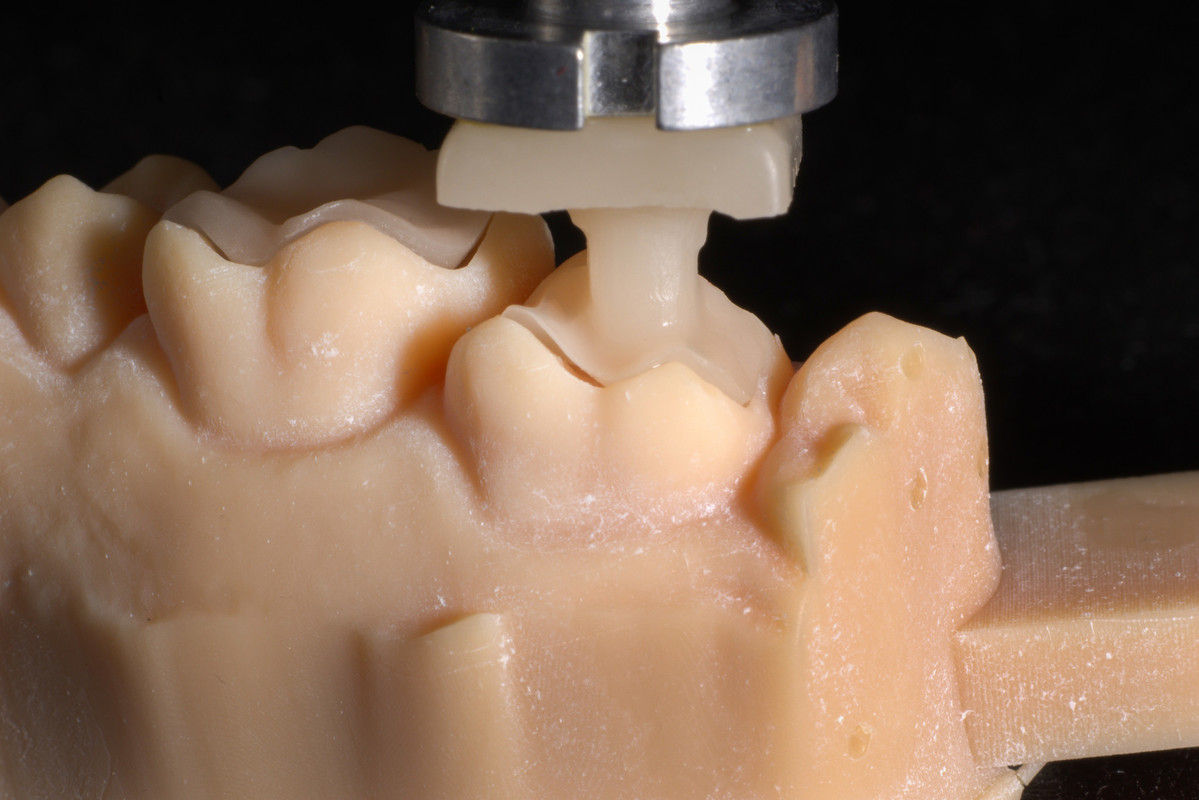 Digitalne rešitve - standard v zobozdravstvu